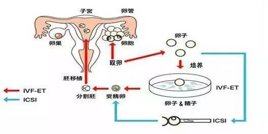 广东捐卵公司